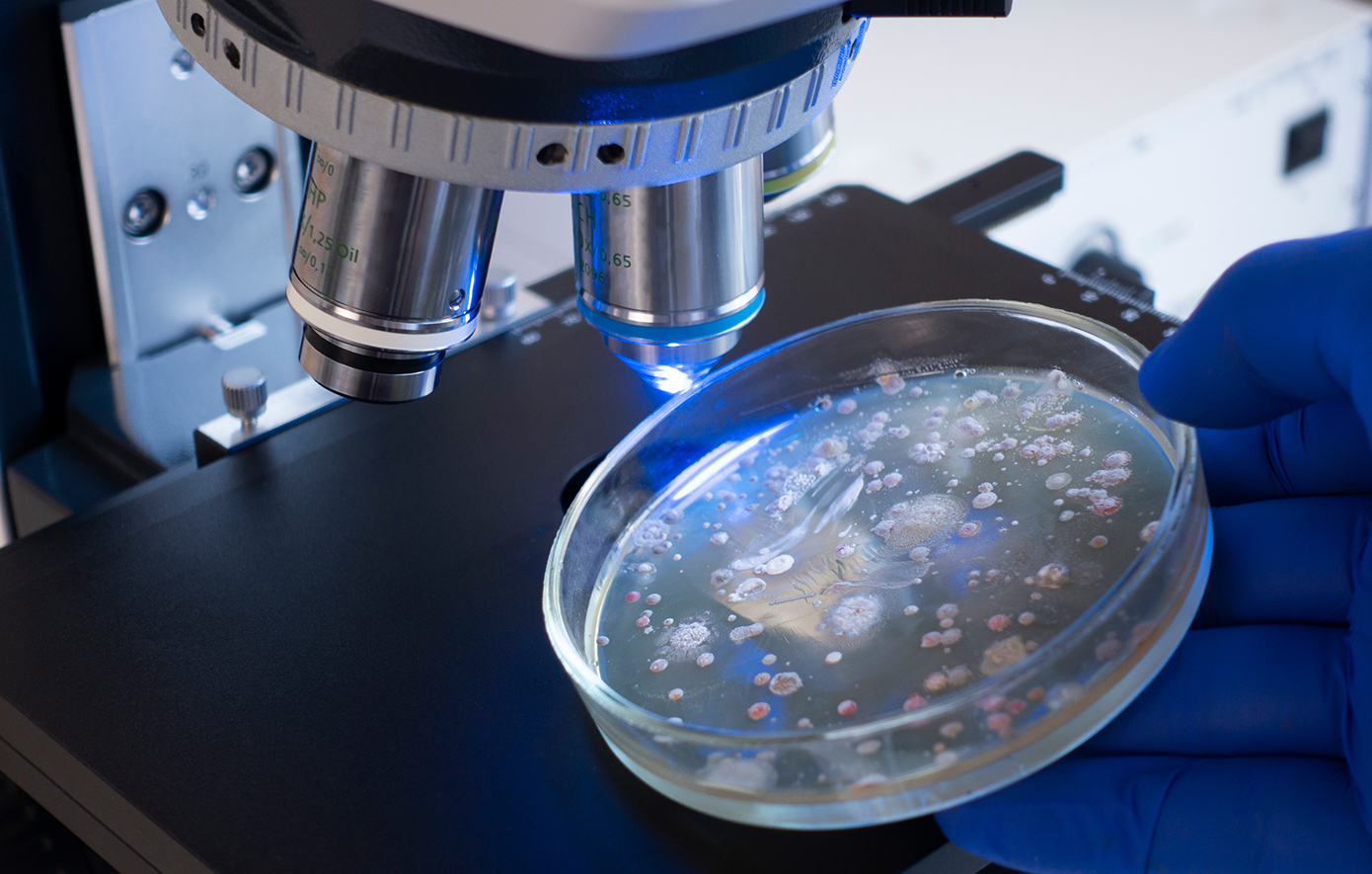 Νέα έρευνα για τη μικροβιακή αντοχή: Είναι πιο εκτεταμένη από όσο πίστευαν οι ερευνητές