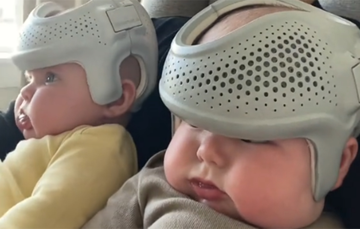 Μητέρα φοράει στα μωρά της κράνη για 23 ώρες το 24ωρο &#8211; Αντιδράσεις στα social media