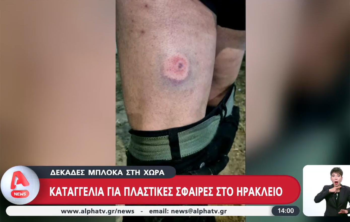 Αγρότες καταγγέλλουν ότι χτυπήθηκαν με πλαστικές σφαίρες από αστυνομικούς &#8211; Τι απαντά η ΕΛ.ΑΣ.