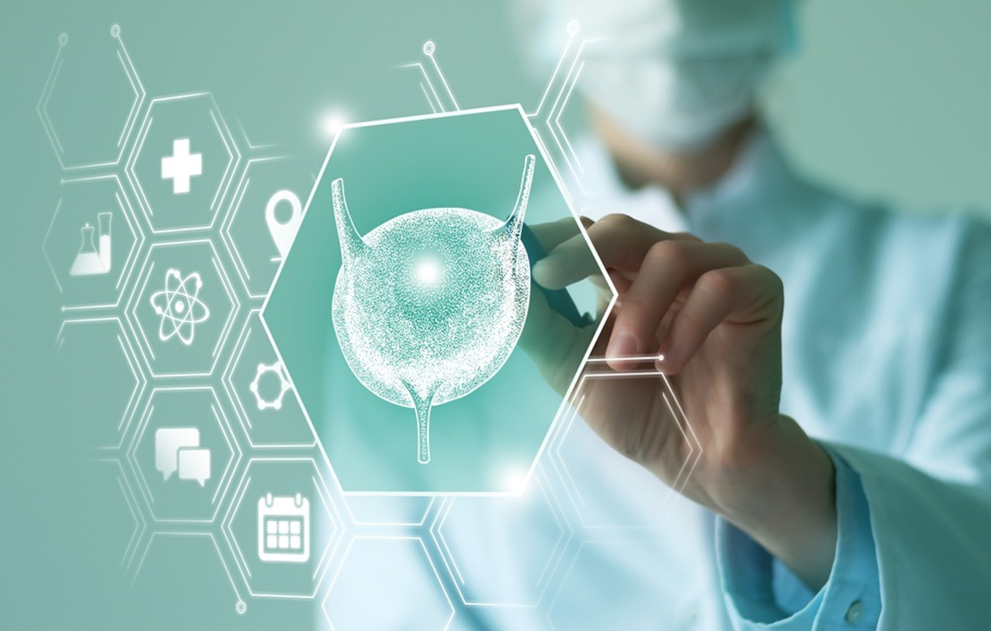 Νέα θεραπευτική επιλογή για τον καρκίνο της ουροδόχου κύστης