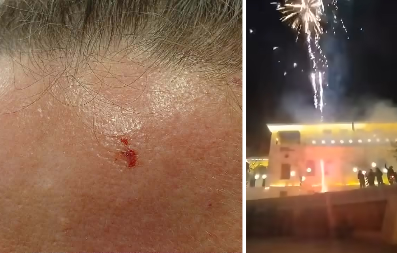 Πανικός σε χριστουγεννιάτικη γιορτή στην Κοζάνη &#8211; Τρόμος και τραυματισμοί από τα πυροτεχνήματα