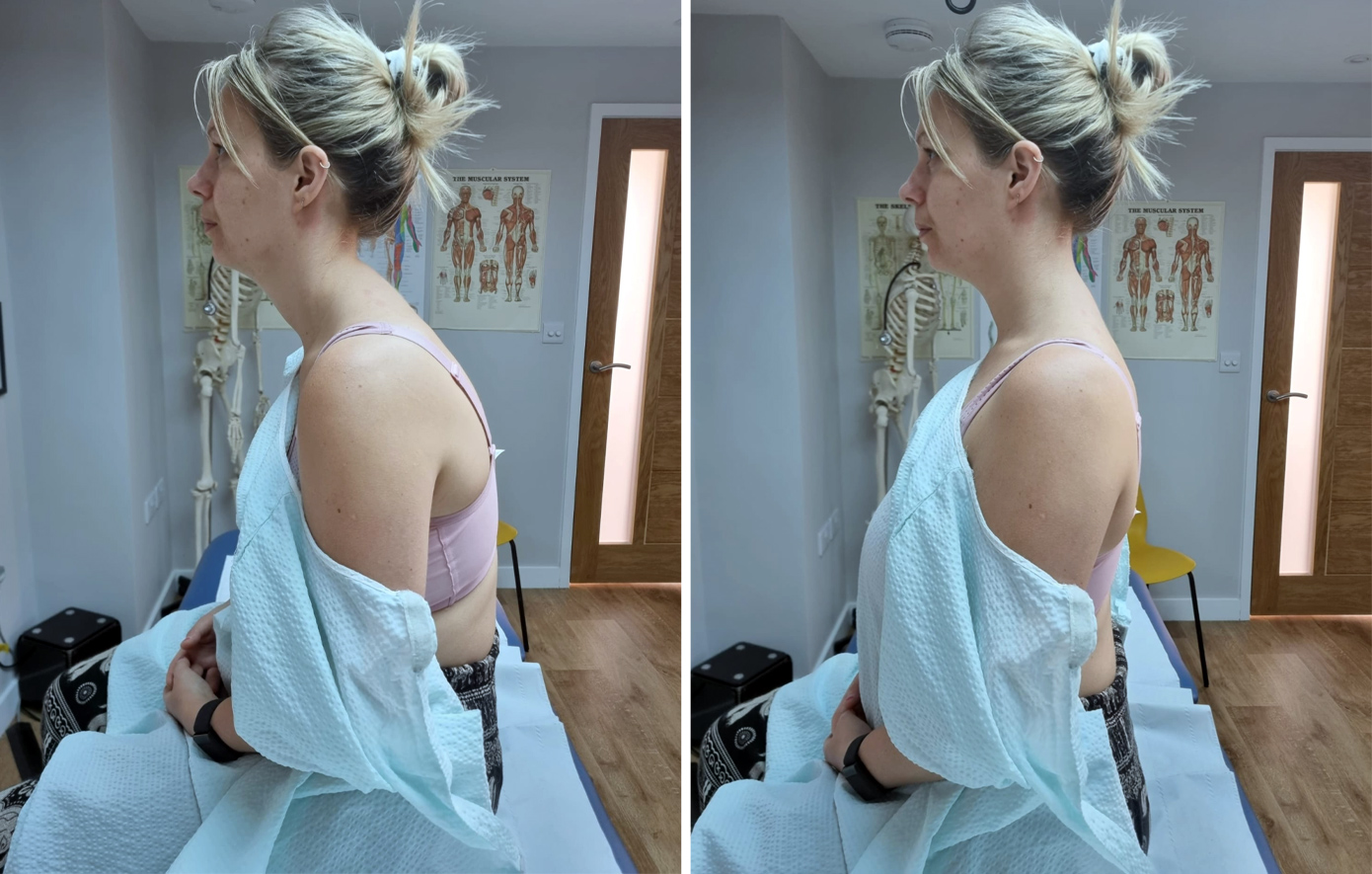 «Παίρνω 1.300 λίρες σε επιδόματα επειδή το στήθος μου είναι τεράστιο και δεν μου επιτρέπει να εργαστώ»