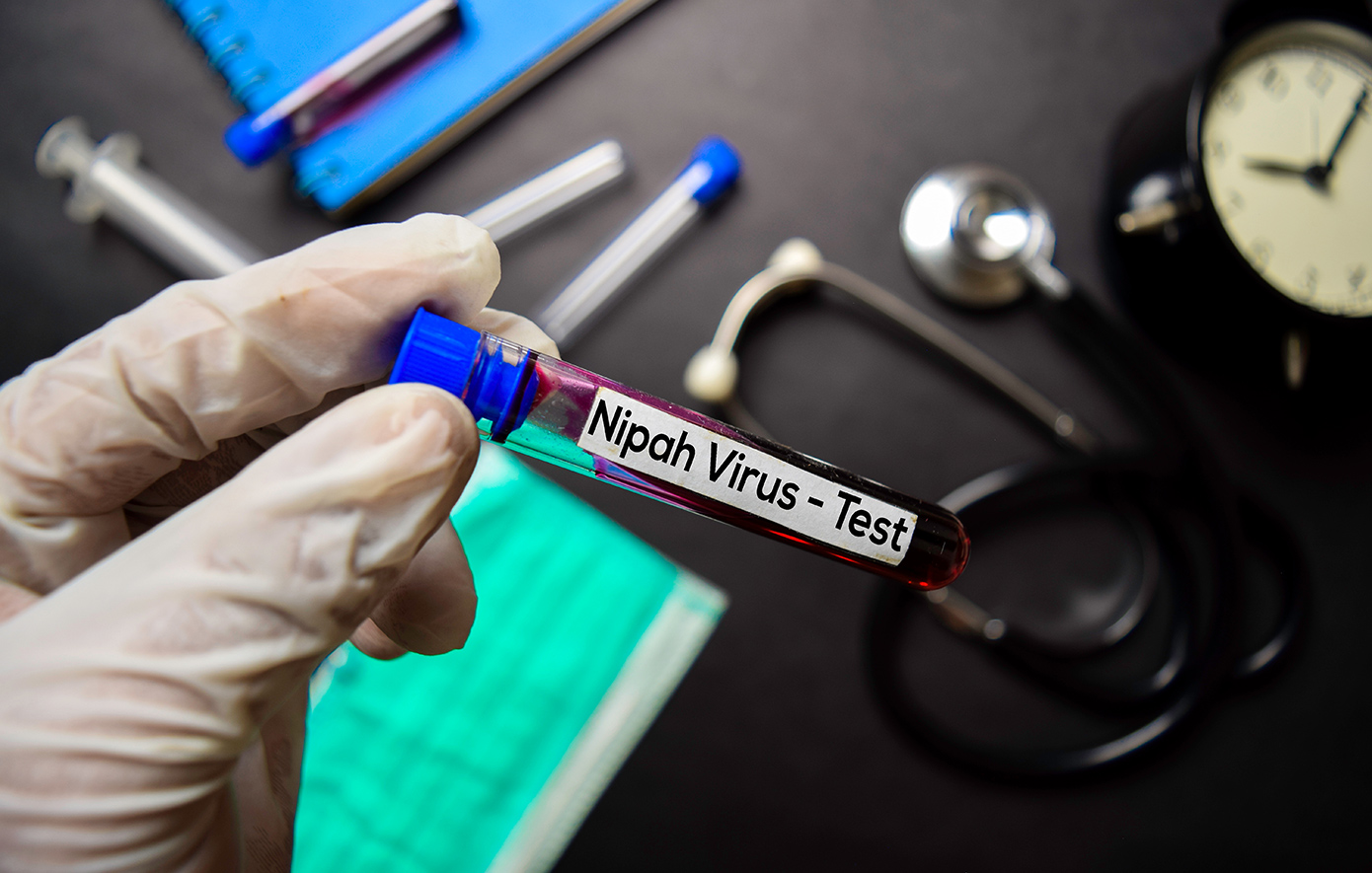 Συναγερμός στην Ινδία: Βρέθηκαν δύο κρούσματα του ιού Νίπα &#8211; «Η κατάσταση είναι υπό έλεγχο»
