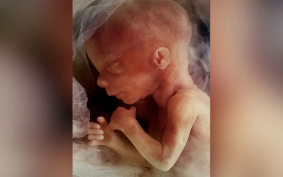 Τα στάδια της ανάπτυξης του εμβρύου στη μήτρα μέσα από ένα εντυπωσιακό βίντεο