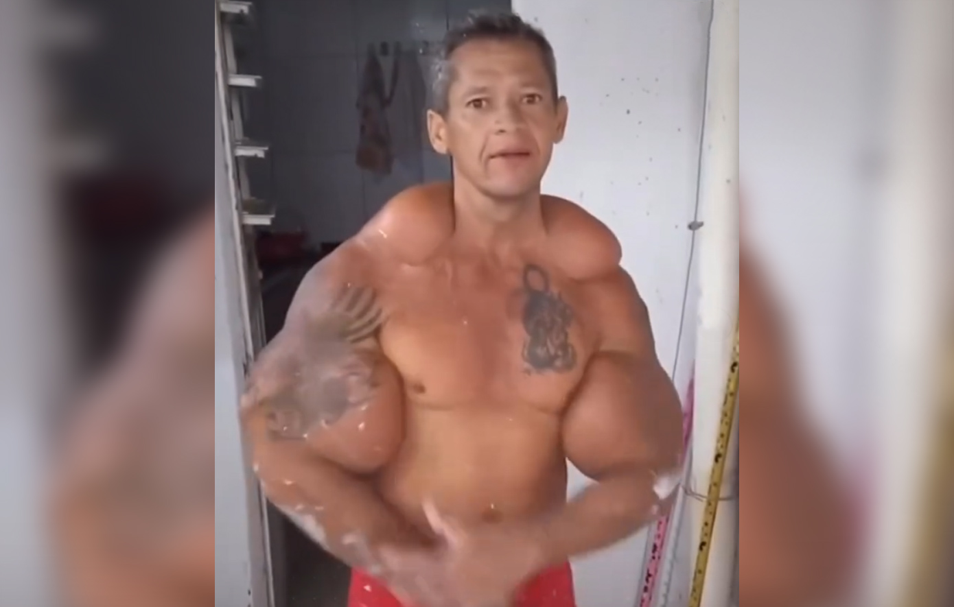 Πέθανε ο Βραζιλιάνος «Ποπάι» &#8211; Η επικίνδυνη εμμονή του με τα διογκωμένα μπράτσα και οι ενέσεις με ορυκτέλαιο