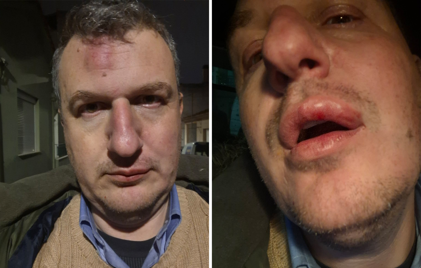 Άγριος ξυλοδαρμός του εκδότη της «Μαγνησίας» έξω από το σπίτι του στον Βόλο &#8211; Τον έριξαν κάτω και τον χτύπησαν στο πρόσωπο