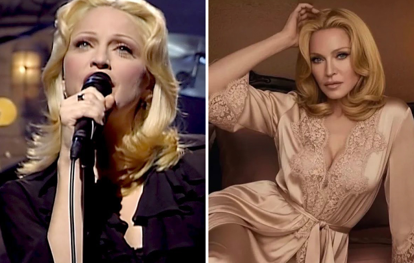 Μαντόνα: Η μεγάλη «επιστροφή» στο πρόσωπο που είχε 30 χρόνια πριν – Τι άλλαξε η βασίλισσα της pop;