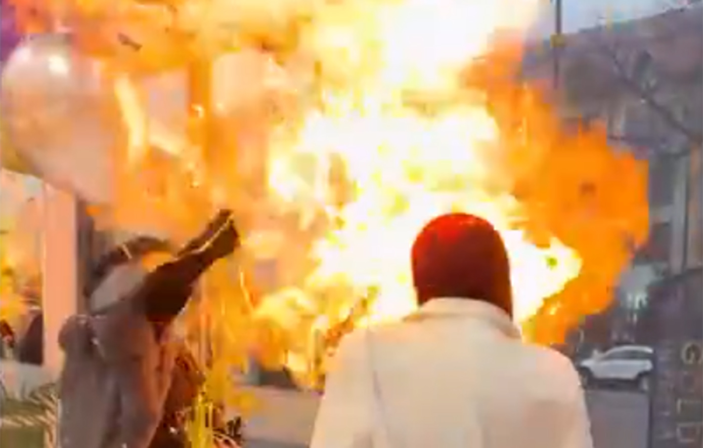 Στιγμές τρόμου σε πάρτι γενεθλίων: Μπαλόνια με υδρογόνο έσκασαν και πήραν φωτιά μπροστά στο πρόσωπο της εορτάζουσας