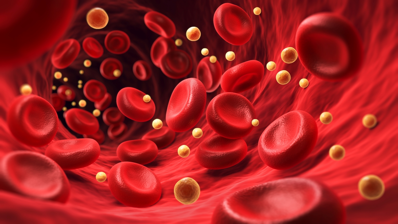 Τα κάνετε όλα σωστά και πάλι έχετε υψηλή χοληστερόλη – Τι φταίει