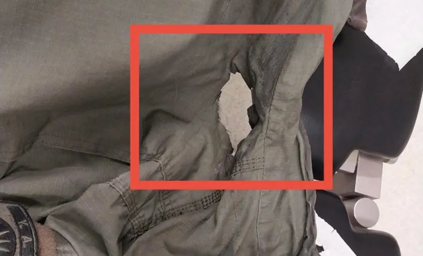 Επεισόδια στο ΑΠΘ: Εγκαύματα αστυνομικού από μολότοφ &#8211; «Πρέπει η αστυνομία να εξελιχθεί στην αντιμετώπιση αυτών των δολοφόνων»