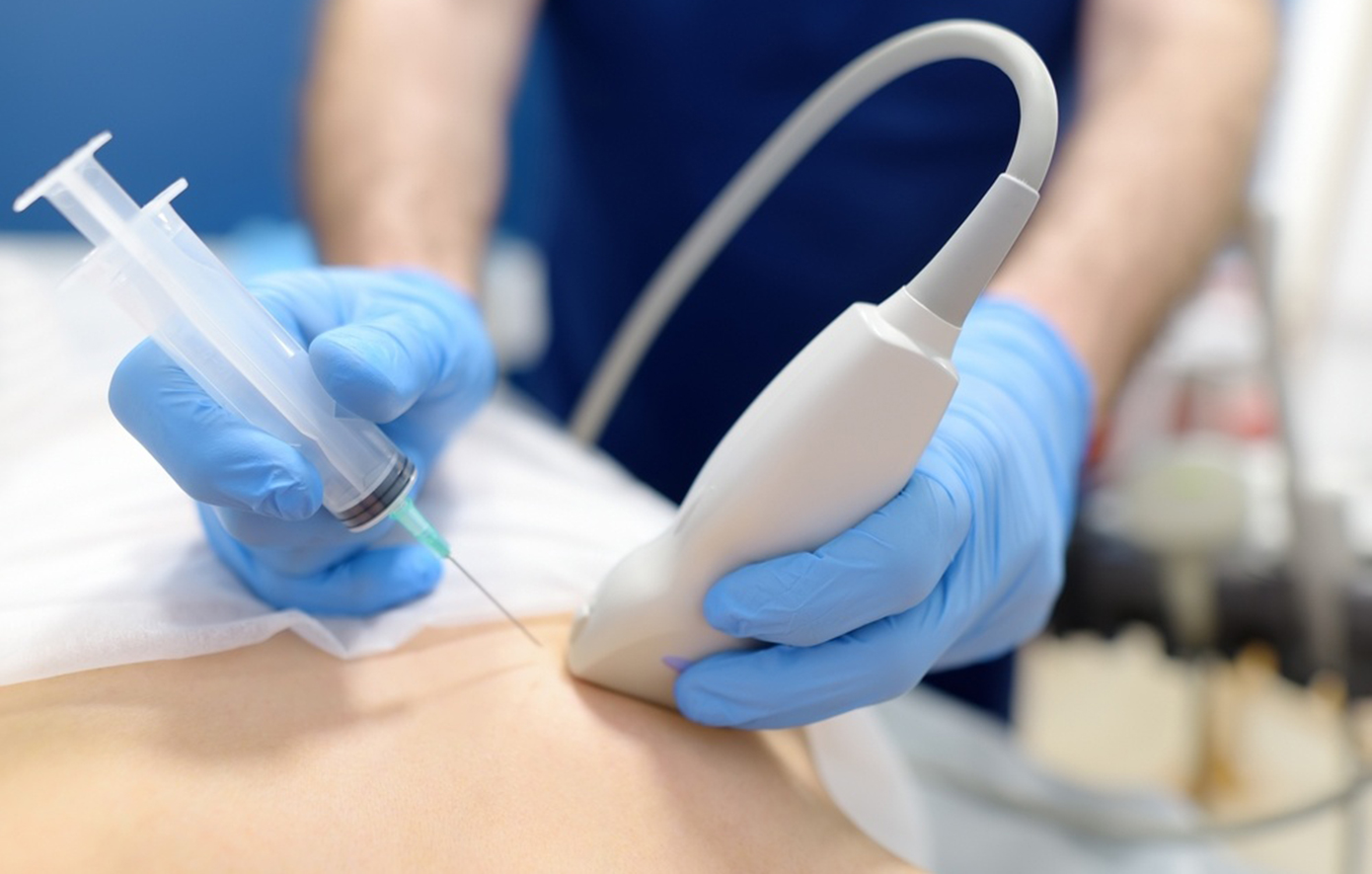 Προεγχειρητική βιοψία μαστού: Οι μύθοι και οι αλήθειες που σώζουν ζωές