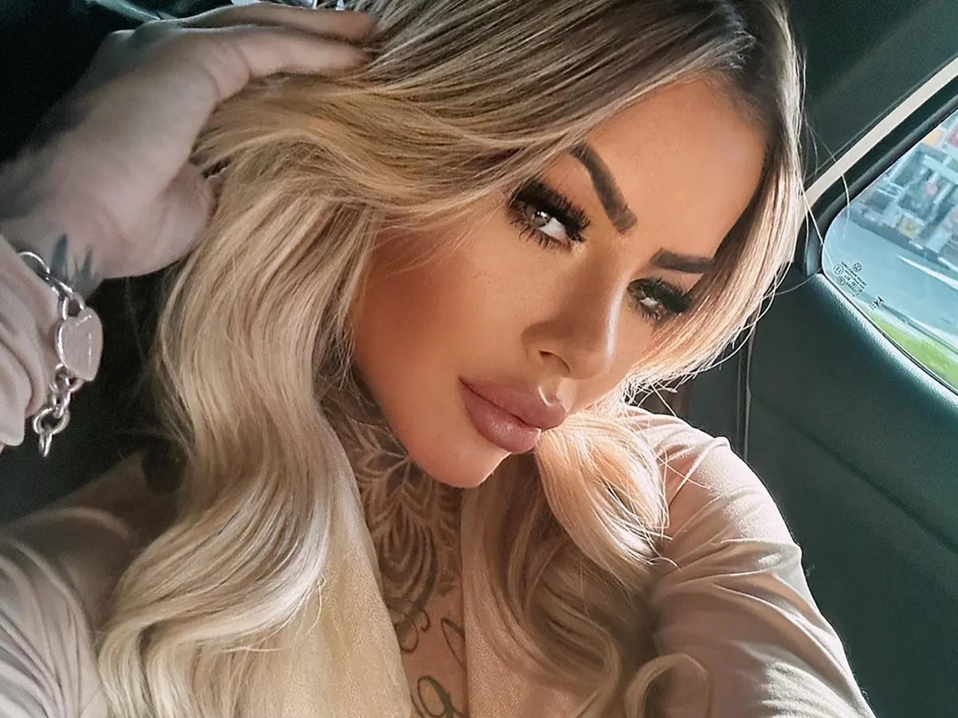 Βραζιλιάνα influencer 27 ετών έχασε τη ζωή της μετά από χειρουργική επέμβαση αισθητικής