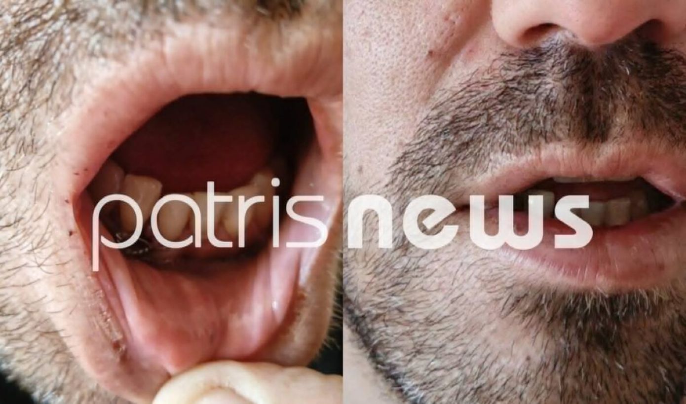 «Με χτυπούσαν επί 15 λεπτά» &#8211; Σοκάρει η άγρια επίθεση στα κρατητήρια της Αστυνομικής Διεύθυνσης Ηλείας