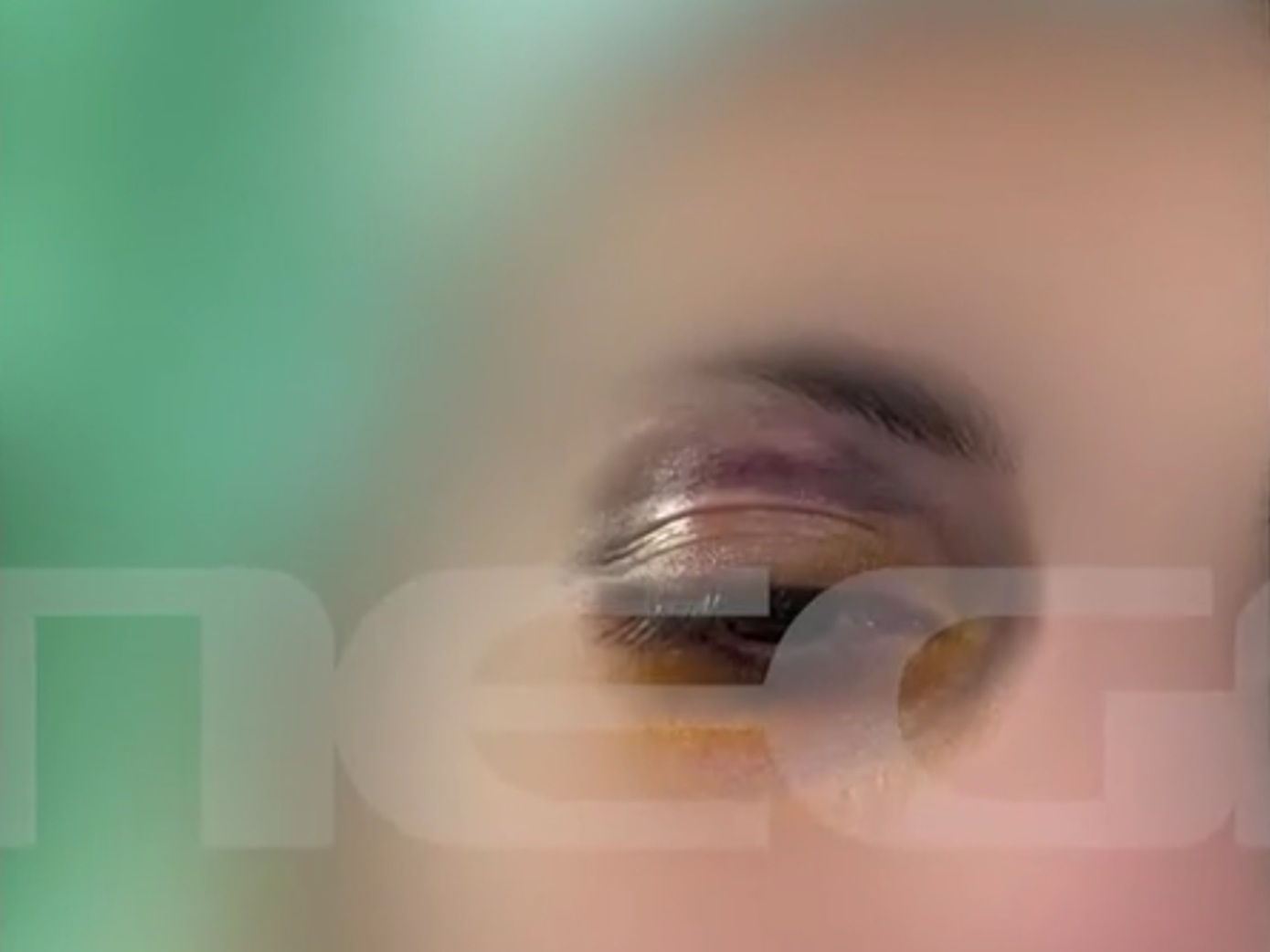 Σοκάρει η περιγραφή 25χρονης που ξυλοκοπήθηκε άγρια από τον σύντροφό της &#8211; Την τραβούσε από τα μαλλιά και της μαύρισε το μάτι