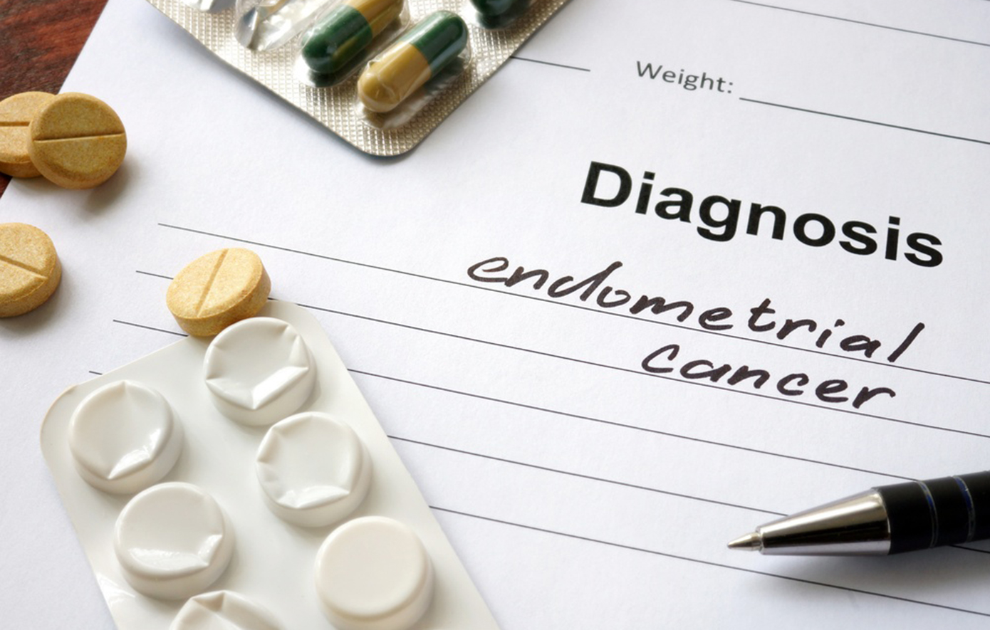 Καρκίνος του ενδομητρίου: Όλες οι νεότερες εξελίξεις σε διάγνωση και θεραπεία