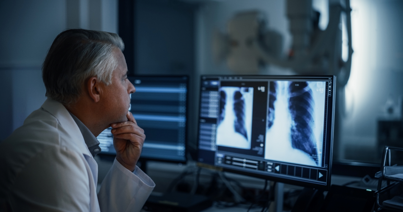 Ο καρκίνος του πνεύμονα αυξάνεται σε μη καπνιστές – Και οι επιστήμονες ψάχνουν τις αιτίες