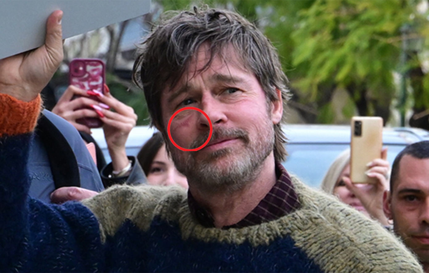 Μπραντ Πιτ: Το «σημάδι» στο πρόσωπο και η αναστάτωση στο κέντρο της Αθήνας για το «The Riders»