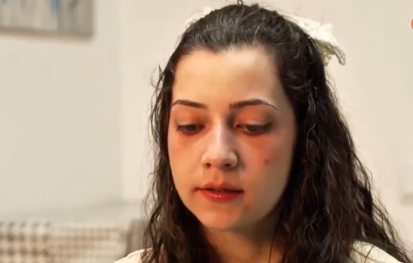 «Ήθελα να την πείσω να αλλάξει γνώμη» &#8211; «Γροθιά στο στομάχι» τα λόγια φίλης της 25χρονης Νοέλια που πέθανε με ευθανασία