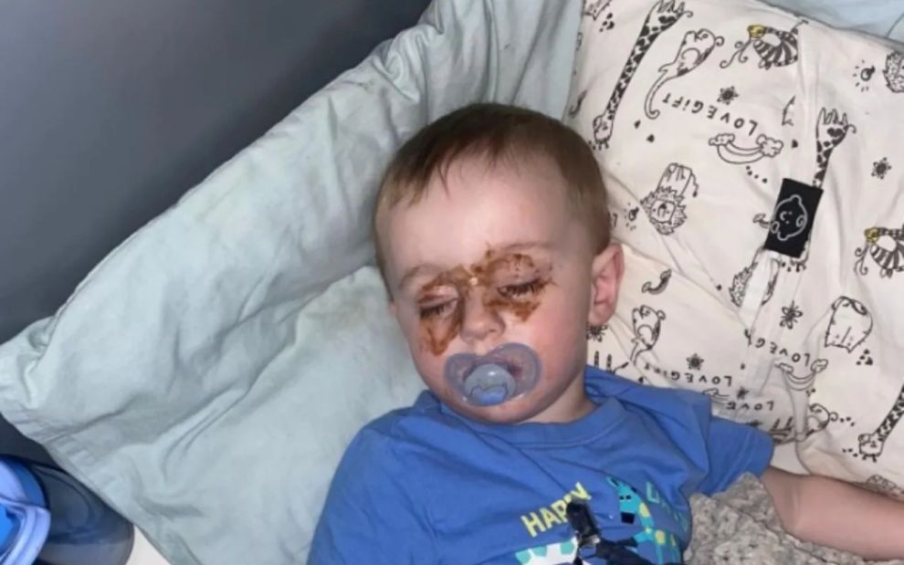 «Τι είναι αυτοί οι καφέ κύκλοι στα μάτια του μωρού;»: Το post που λύγισε πάνω από 1 εκατ. θεατές