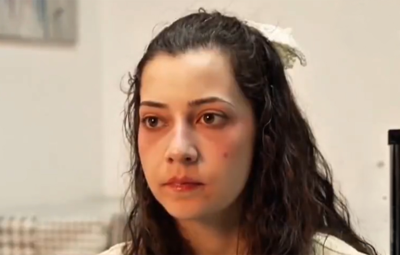 Νοέλια Καστίγιο Ράμος: Πέθανε με ευθανασία η 25χρονη που βιάστηκε ομαδικά και έμεινε τετραπληγική