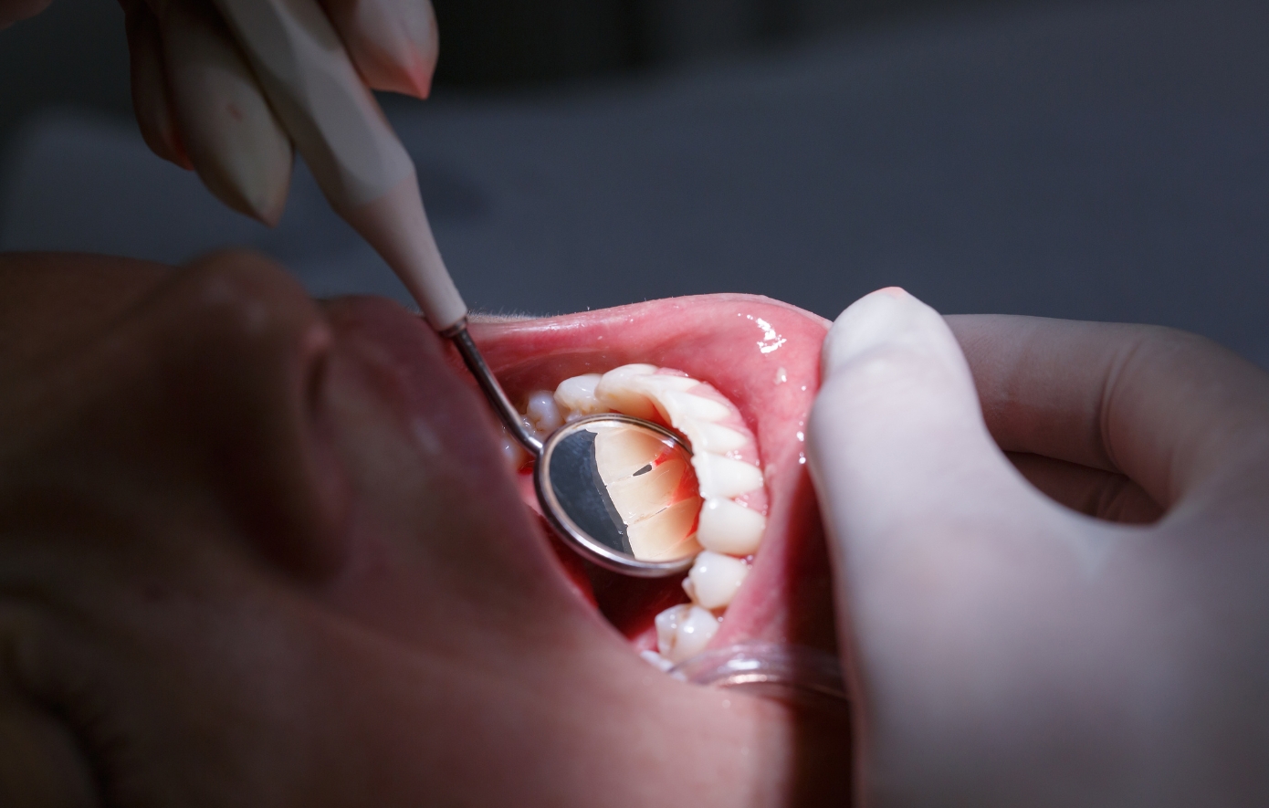 Πόσο συχνά πηγαίνουν οι Έλληνες στον οδοντίατρο; Και τι μπορούν να κάνουν όσοι φοβούνται; Ένας οδοντίατρος εξηγεί