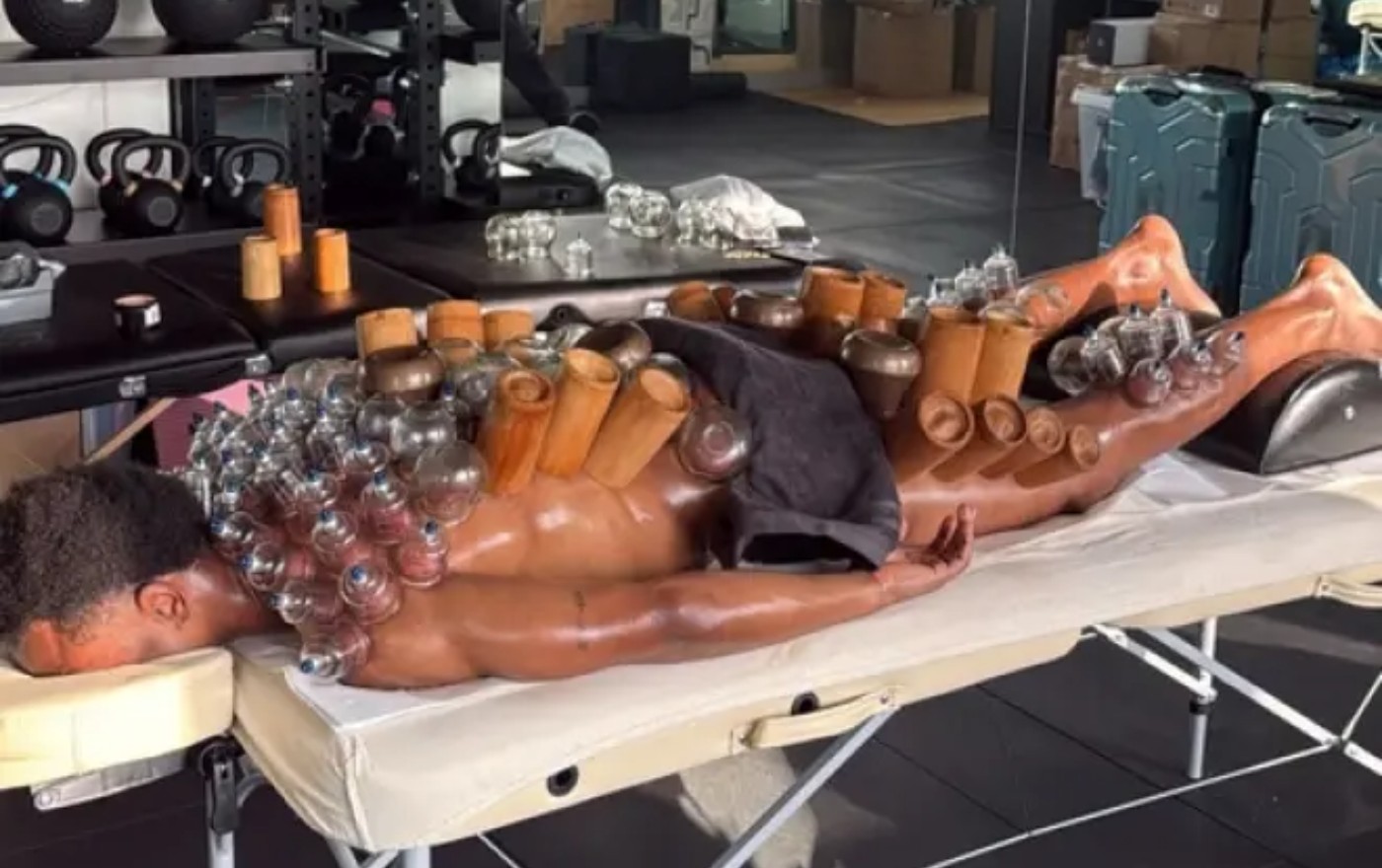 Γιουβέντους: Ο Οπέντα δοκιμάζει τα πάντα για να βρει το γκολ – Ακόμη και τη «θεραπεία με βεντούζες»