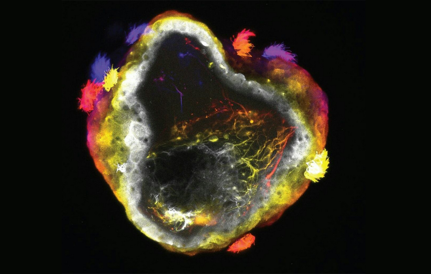 Νευρορομπότ: Η νέα γενιά «ζωντανών» μηχανών με εγκέφαλο αλλάζει τα δεδομένα στην επιστήμη