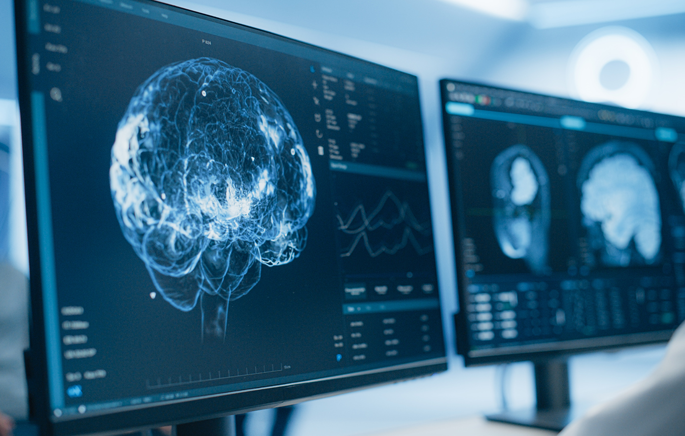 Τι είναι το «θαυματουργό» γραφένιο που φέρνει ελπίδα για Πάρκινσον και επιληψία