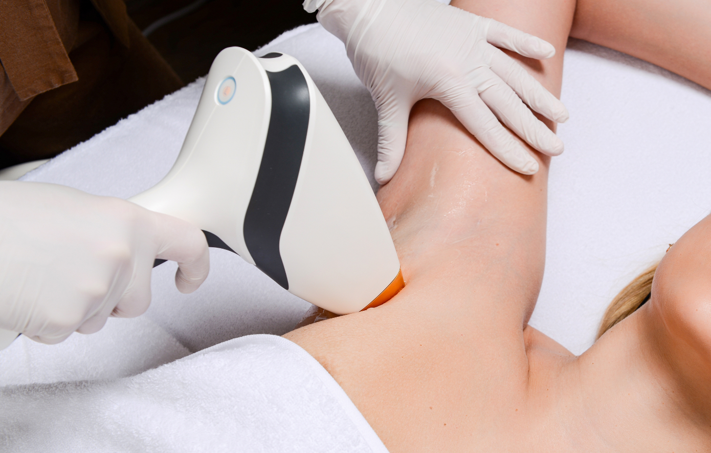 Laser αποτρίχωσης τους καλοκαιρινούς μήνες: Όλα όσα πρέπει να γνωρίζετε