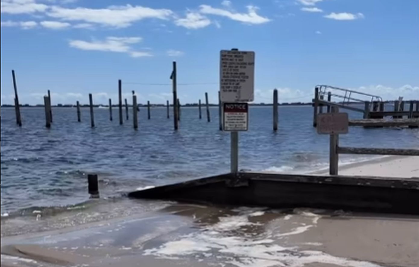 Συναγερμός στις ΗΠΑ για σαρκοφάγο βακτήριο στα νερά του Long Island στη Νέα Υόρκη &#8211; Μπορεί να προκαλέσει θάνατο σε 48 ώρες