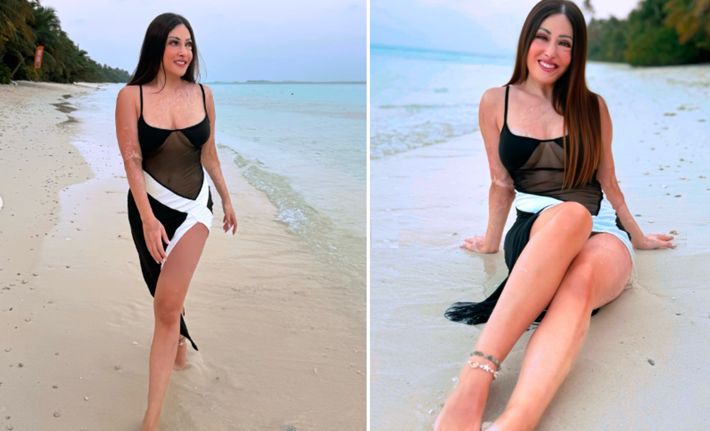 Συγκινεί η Ιωάννα Παλιοσπύρου: Έμαθα να αγαπάω το σώμα μου όχι γιατί είναι τέλειο, αλλά γιατί με κράτησε ζωντανή