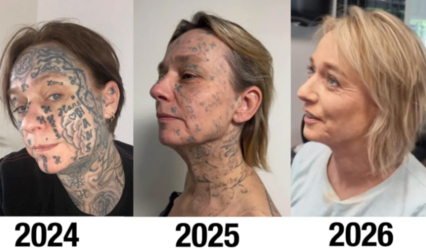 Φριχτή υπόθεση κακοποίησης: Άνδρας έκανε 250 τατουάζ με το όνομα και τα αρχικά του στο πρόσωπο και το σώμα της συντρόφου του