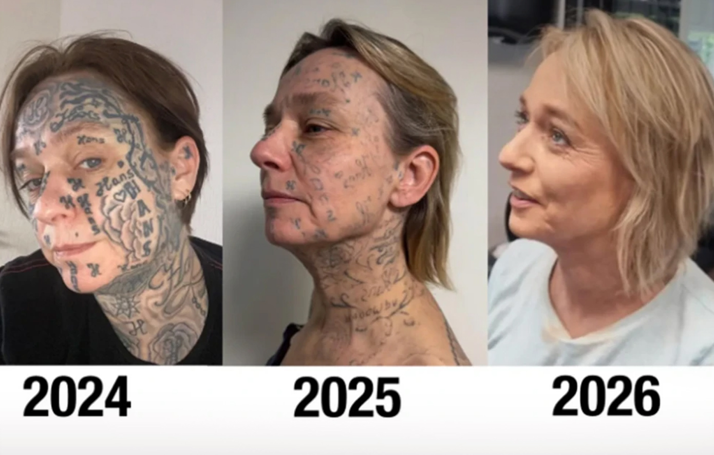 Φριχτή υπόθεση κακοποίησης: Άνδρας έκανε 250 τατουάζ με το όνομα και τα αρχικά του στο πρόσωπο και το σώμα της συντρόφου του