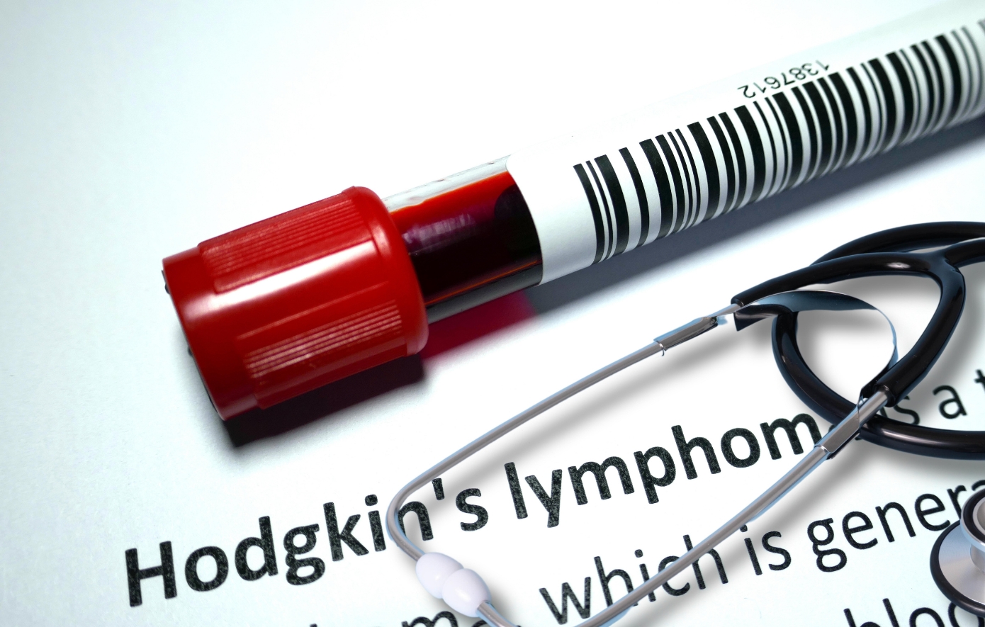 Νίκη απέναντι στο λέμφωμα Hodgkin: Νέα θεραπευτική επιλογή για ασθενείς σε όλη την Ευρώπη