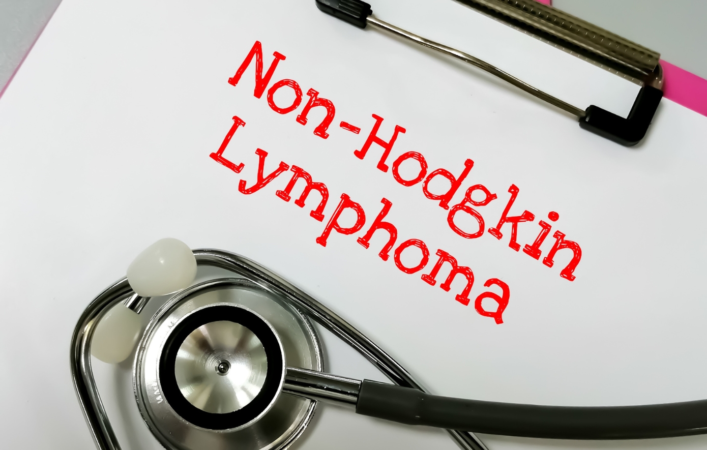 Μη-Hodgkin λέμφωμα: Η μάχη που σήμερα κερδίζεται όλο και συχνότερα – Οι νέες θεραπείες αλλάζουν τις προοπτικές ζωής χιλιάδων ασθενών