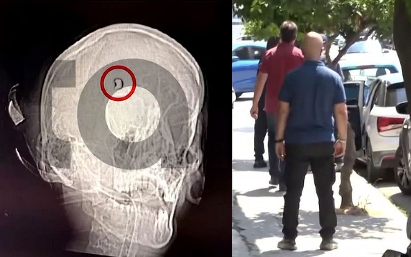 Η μαγνητική του 20χρονου από το Άργος δείχνει τη σφαίρα στο κεφάλι &#8211; Δεν είναι εξοστρακισμός, αλλά ευθεία βολή