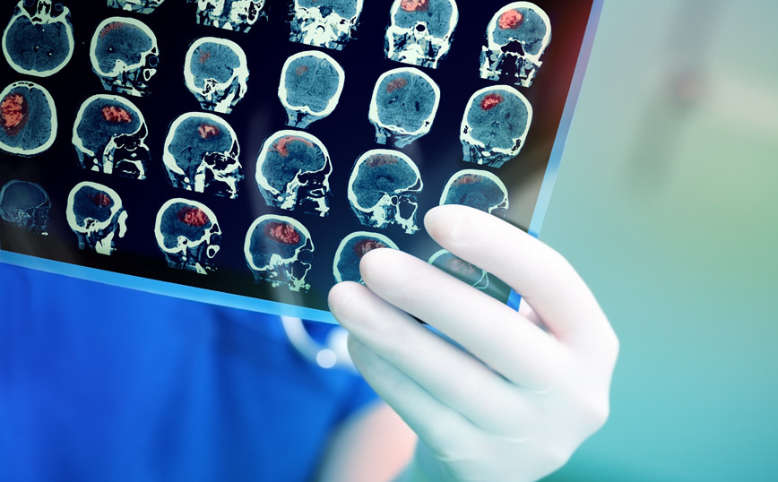 Young man from Britain had a seizure and began to speak French fluently