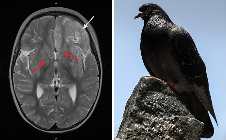 Tragic death of two-year-old from rare pigeon virus – ‘He’s only the fifth person we know of who has died from it’