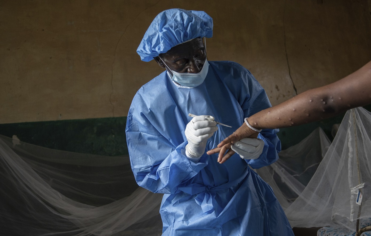 After Ebola, now MPOX: New Nightmare in Sierra Leone