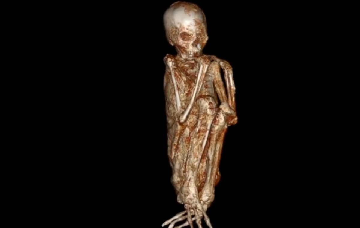 Continues mystery with the “extraterrestrial” mummies of Peru- What DNA exams showed