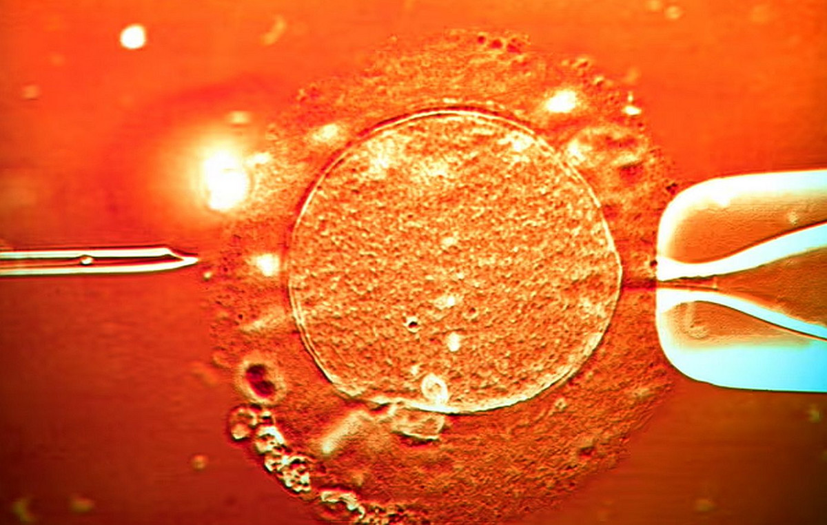 Alarm in Europe: Sperm Donor with carcinogenic mutation used to arrest 67 children – 10 developed cancer Alarm in Europe: Sperm Donor with carcinogenic mutation used to arrest 67 children – 10 developed cancer