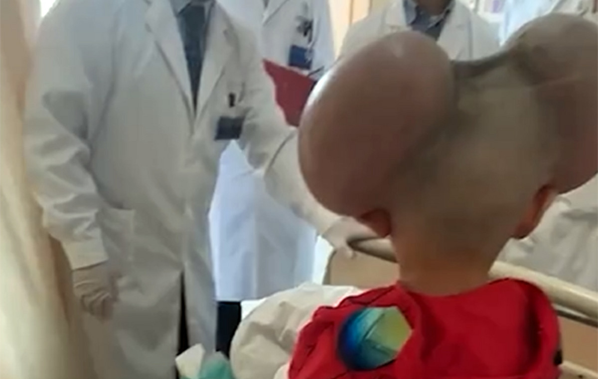 The story of the little Qibao: was called “Mickey Mouse” because of rare skin disease