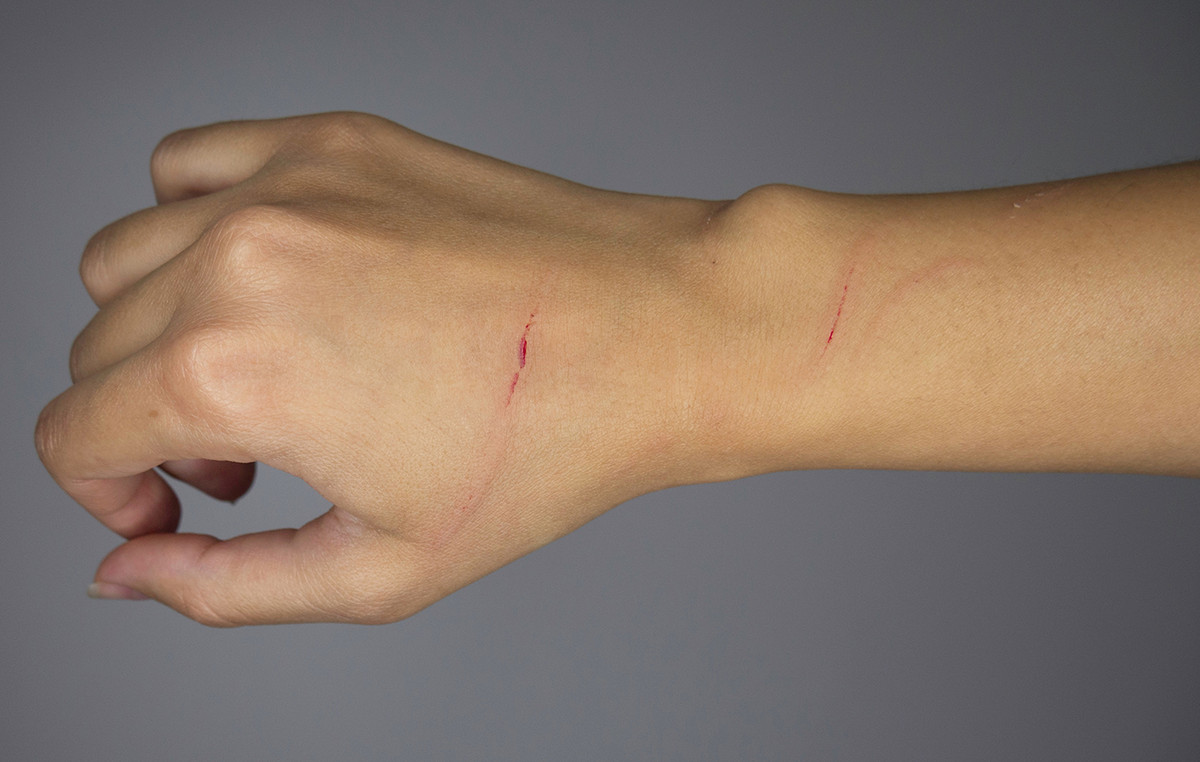 She scratched her a puppy and didn’t matter, but eventually cost her life