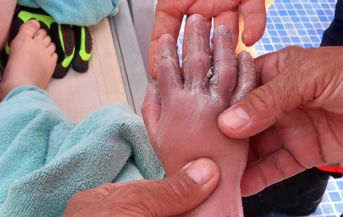 Pipe in the hotel pool was sucked 4 years – see photos