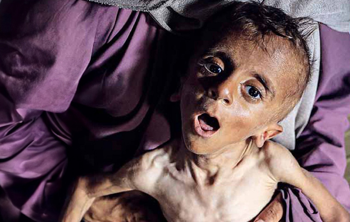 Daily Express’s shocking cover with skeletal baby in Gaza – “For God’s name, stop now”
