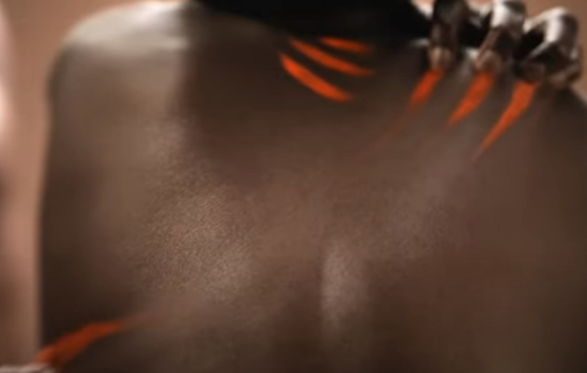 Salle with now forbidden advertising implying that black skin is more problematic than white