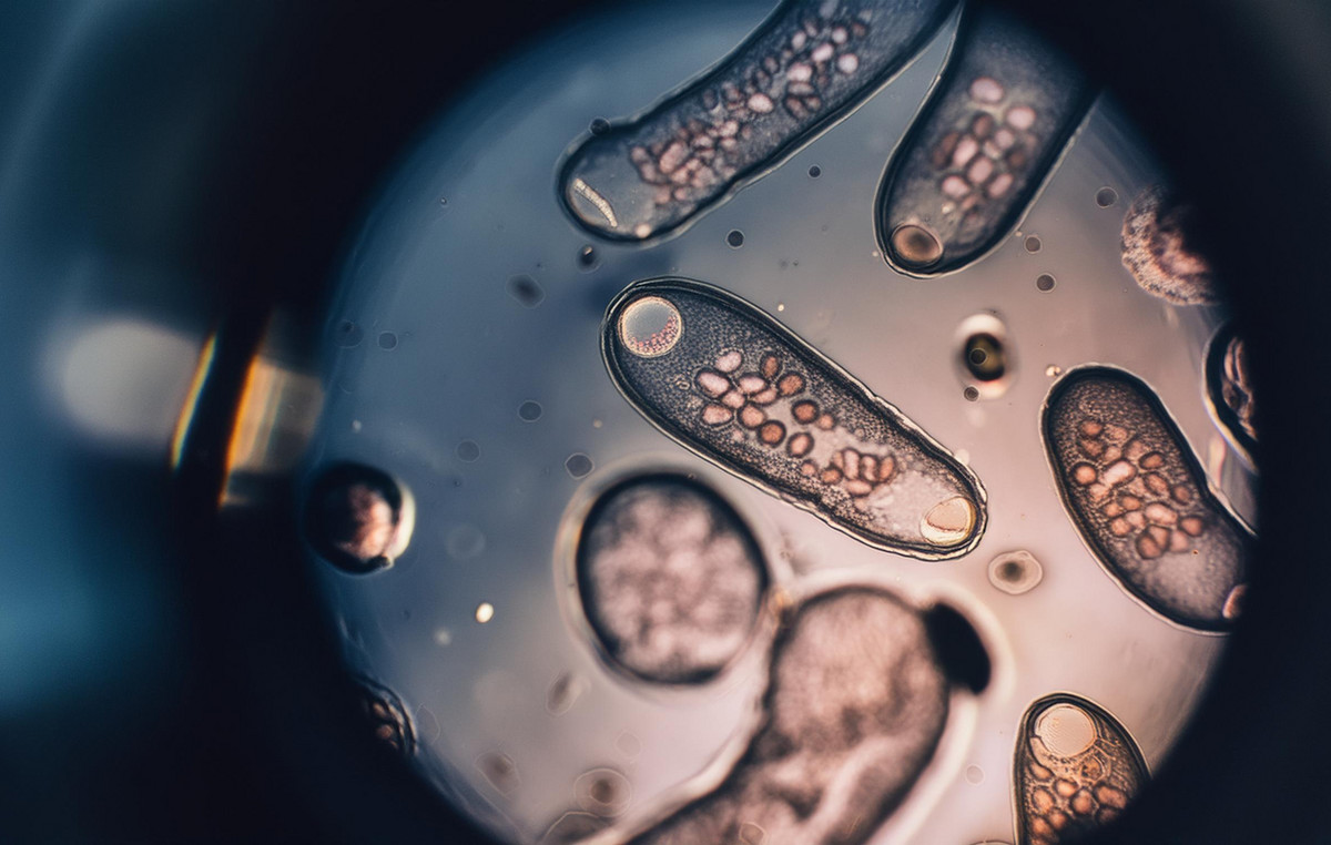 A deadly pest eating flesh was first found in a human man in the US – What is Screwworm?