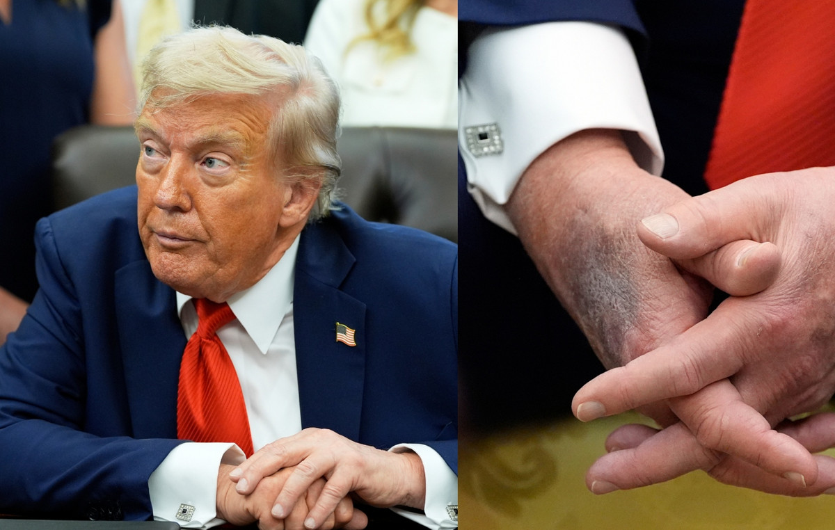 Trump appeared again with ink in his hand – what happens to his health, what the White House answers