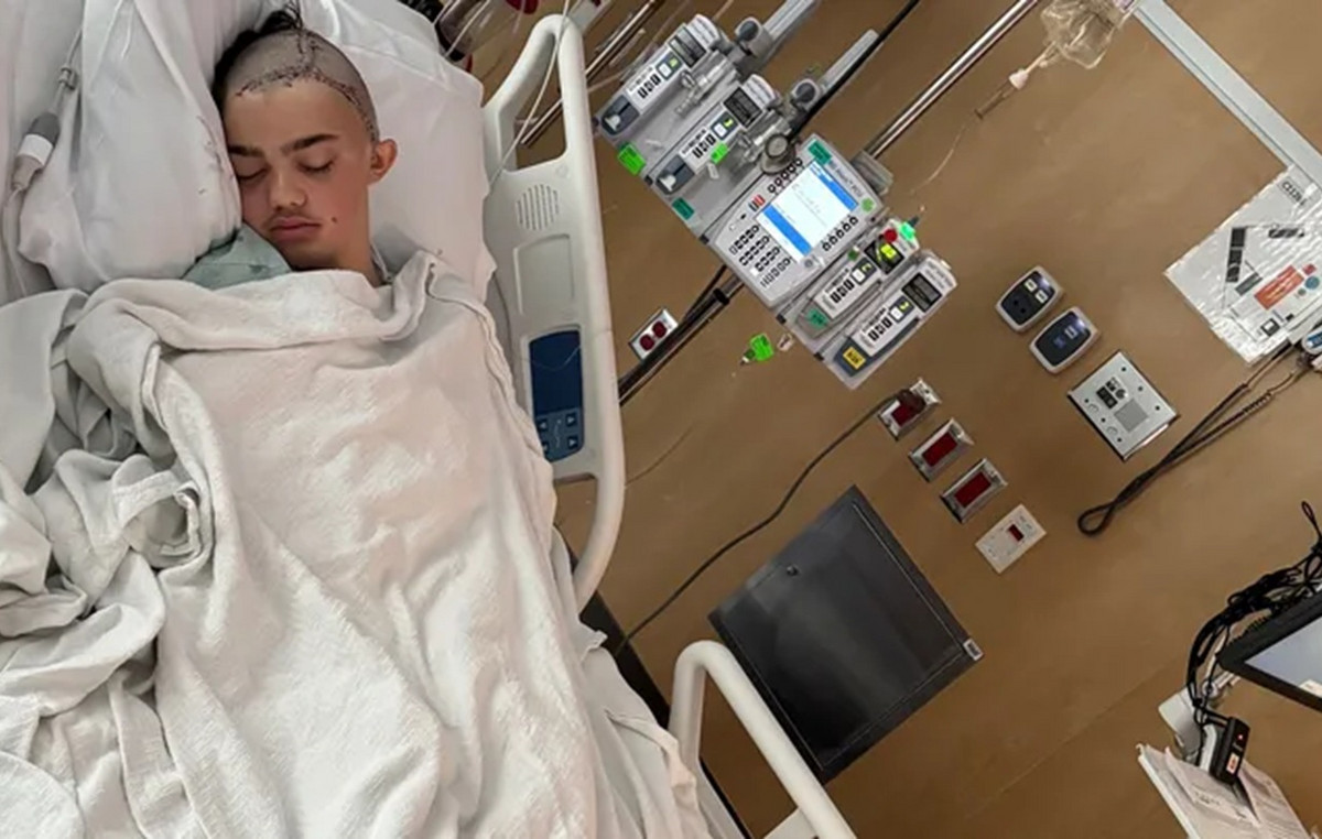 Feritous 14 -year -old injury: Surgeons removed parts of his skull and put 60 stitches