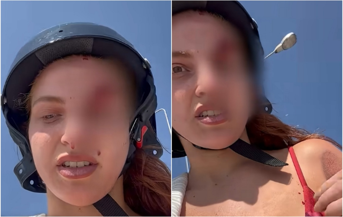 “What are you trying to prove?”: Reactions to a bikini reality stars that uploaded a blood with a blood accident with a motorbike with a motorbike “What are you trying to prove?”: Reactions to a bikini reality stars that uploaded a blood with a blood accident with a motorbike with a motorbike